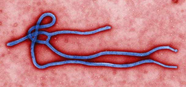 about ebola - for some reason we don't have an alt tag here